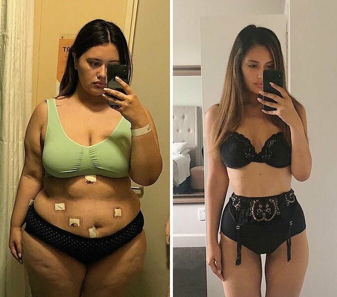 Vajza para dhe pas humbjes së peshës me kapsula KETO Complete